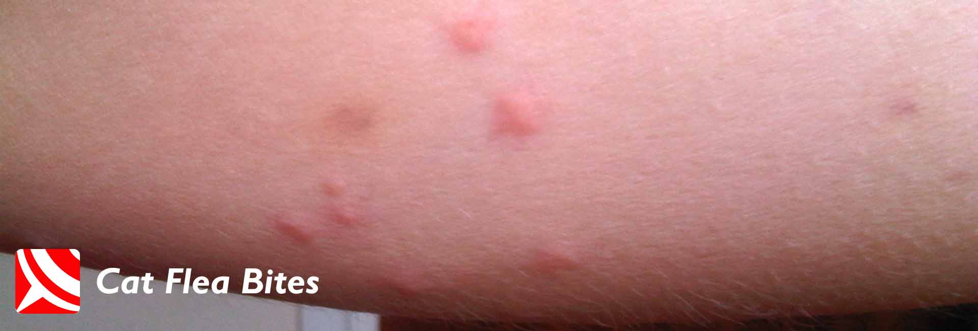 cat flea bites on humans